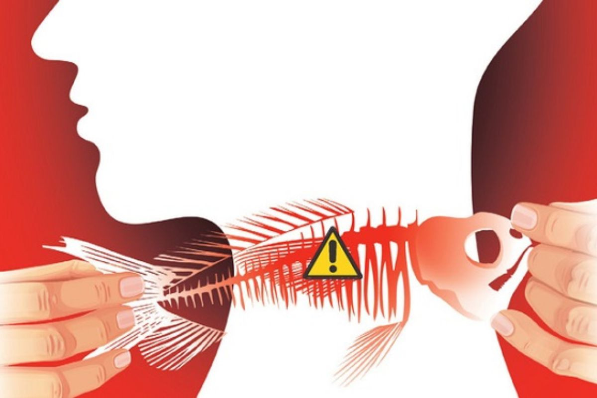 Hóc xương cá sẽ tự khỏi sau 2 - 3 tiếng đồng hồ nếu xương cá có kích thước nhỏ và mềm