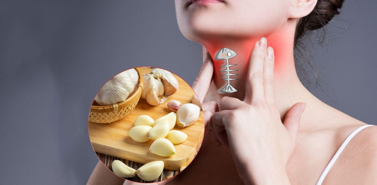 Sử dụng tỏi để chữa hóc xương cá là phương pháp an toàn và có hiệu quả cao