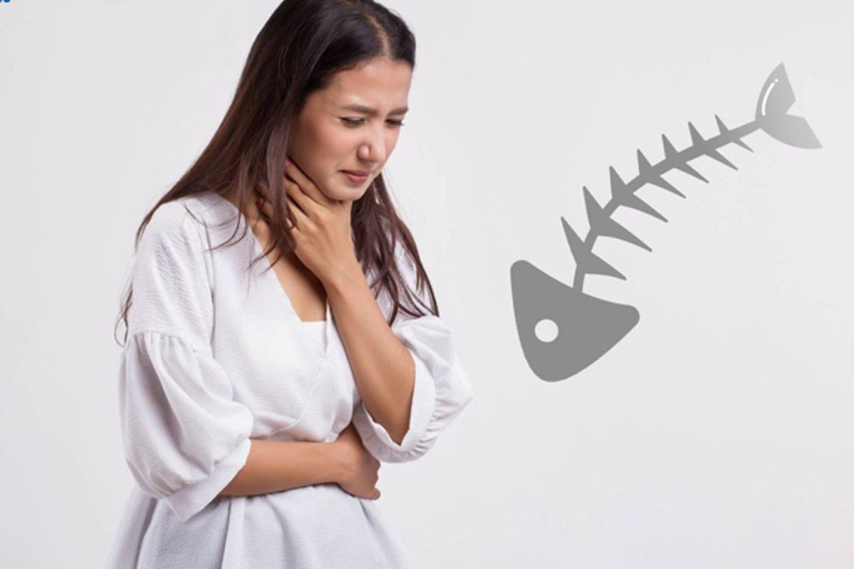 Hóc xương cá ở cổ họng lâu ngày có thể gây nhiễm trùng, ngạt thở và dẫn đến tử vong